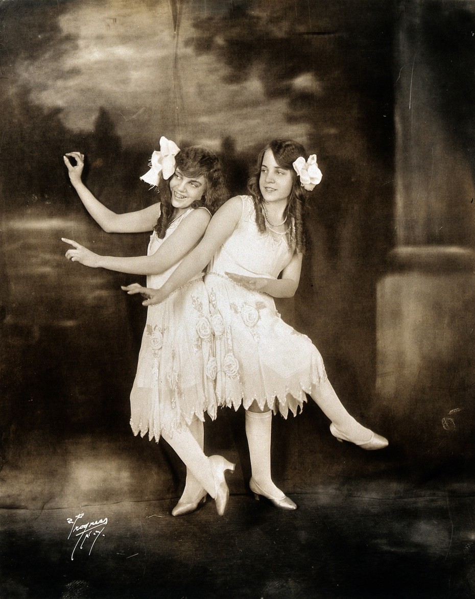 V0029594 Daisy and Violet Hilton, conjoined twins, dancing. Photograp Credit: Wellcome Library, London. Wellcome Images images@wellcome.ac.uk http://wellcomeimages.org Daisy and Violet Hilton, conjoined twins, dancing. Photograph, c. 1927. 1930 Published:  -  Copyrighted work available under Creative Commons Attribution only licence CC BY 4.0 http://creativecommons.org/licenses/by/4.0/